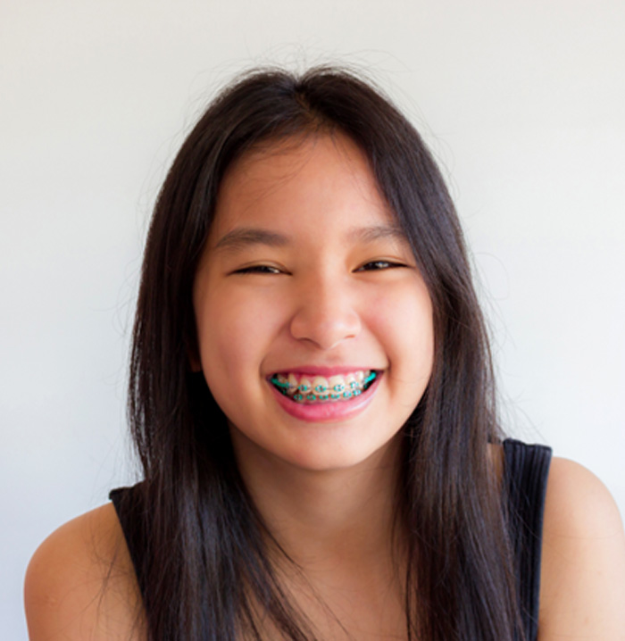 Portrait of smiling teen girl with braces