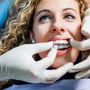 Orthodontist placing Invisalign tray for patient