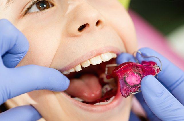 Orthodontist placing a child's oral appliance