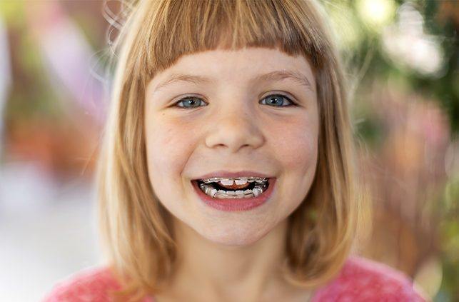 Young girl with pediatric orthodontics braces smiling