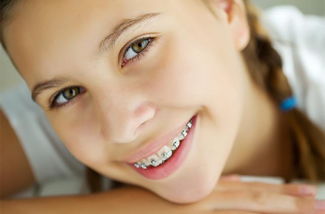 Young woman with traditional bracs smiling