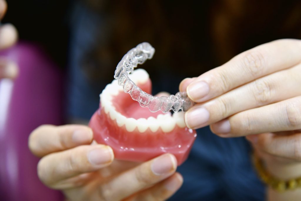 Orthodontist placing Invisalign aligners on model of teeth