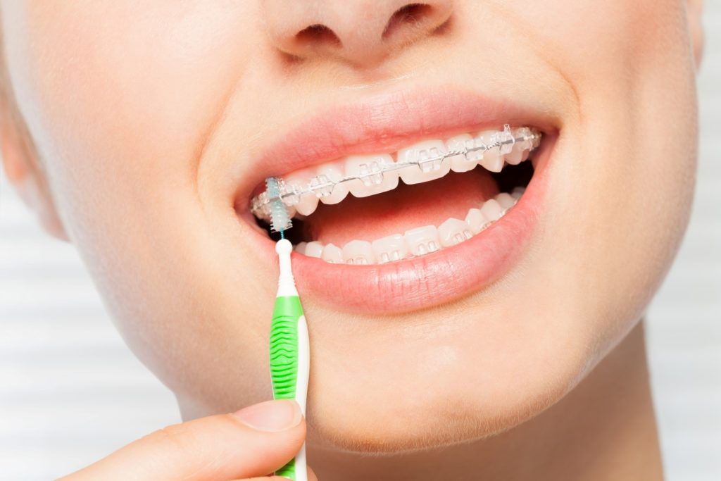 Smiling patient using special brush to clean braces